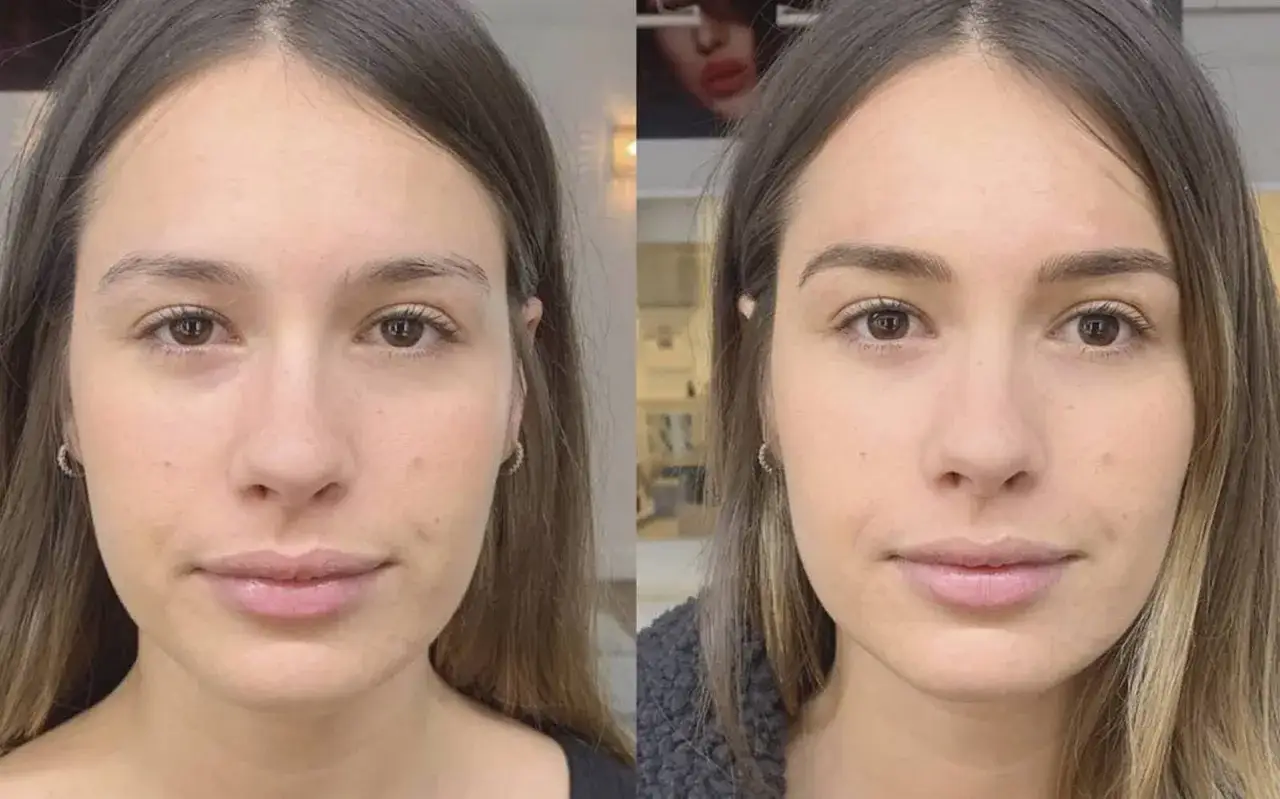 Comparativa de microblading cejas: antes y despu&eacute;s. Las cejas de la mujer lucen m&aacute;s definidas y pobladas tras el tratamiento.