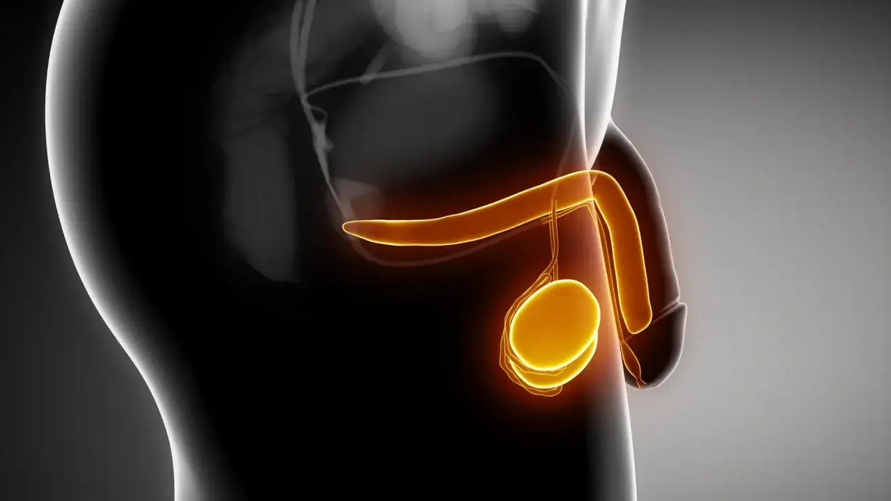 Anatomische Darstellung des männlichen Genitalbereichs mit leuchtend orangefarbenen Strukturen, die auf einen möglichen tumor am penis oder Hoden hinweisen.