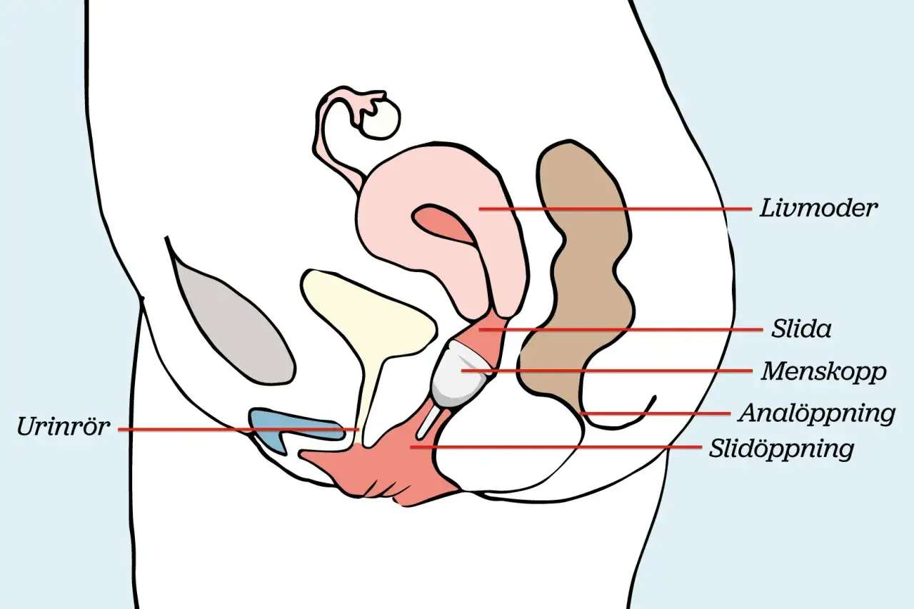 Illustration som visar hur funkar menskopp i livmodern och slidan.