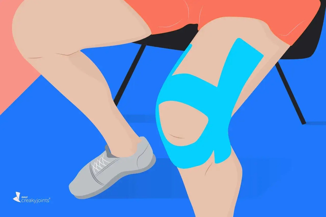 Knie tapen bei Schmerzen: Ein Bein mit blauem Kinesio-Tape am Knie, um Unterst&uuml;tzung zu bieten.