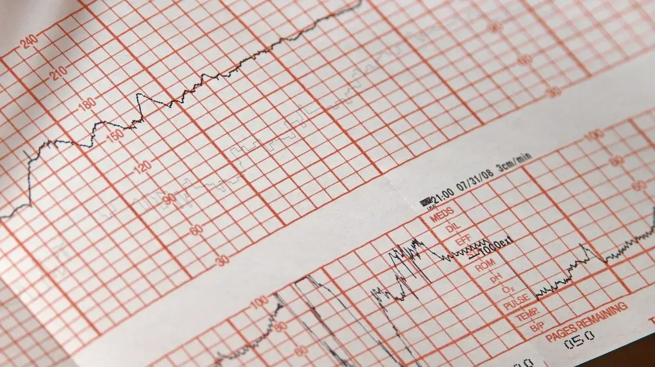 ekg vs echo serca
