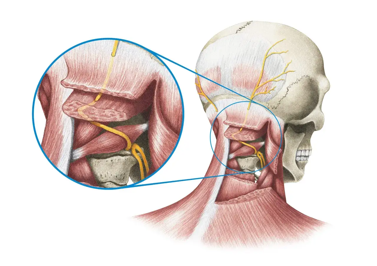 Anatomische Darstellung des Sch&auml;dels und Nackens mit hervorgehobenen Nerven. M&ouml;gliche Ursache f&uuml;r Nervenschmerzen Hinterkopf.