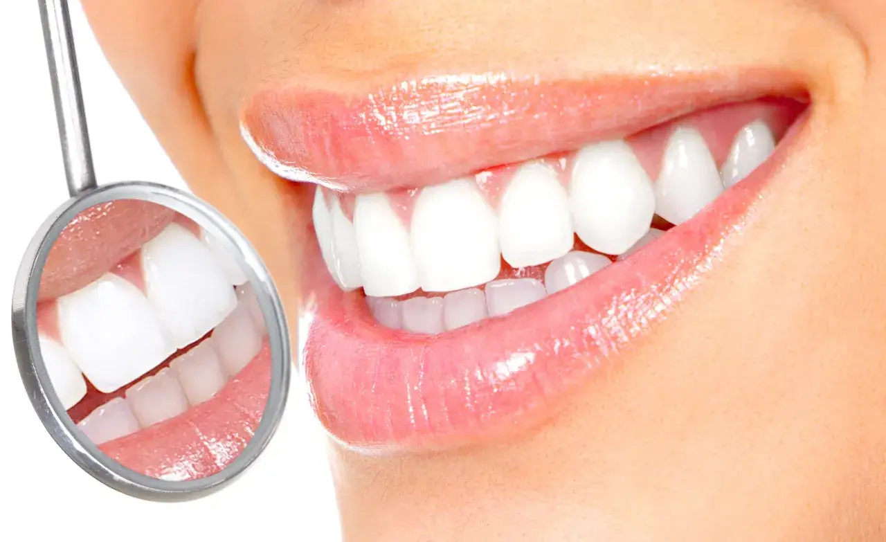 Uśmiech z lśniącymi zębami, widoczne w lustrze dentystycznym. Fluor wzmacnia szkliwo, chroniąc przed pr&oacute;chnicą.