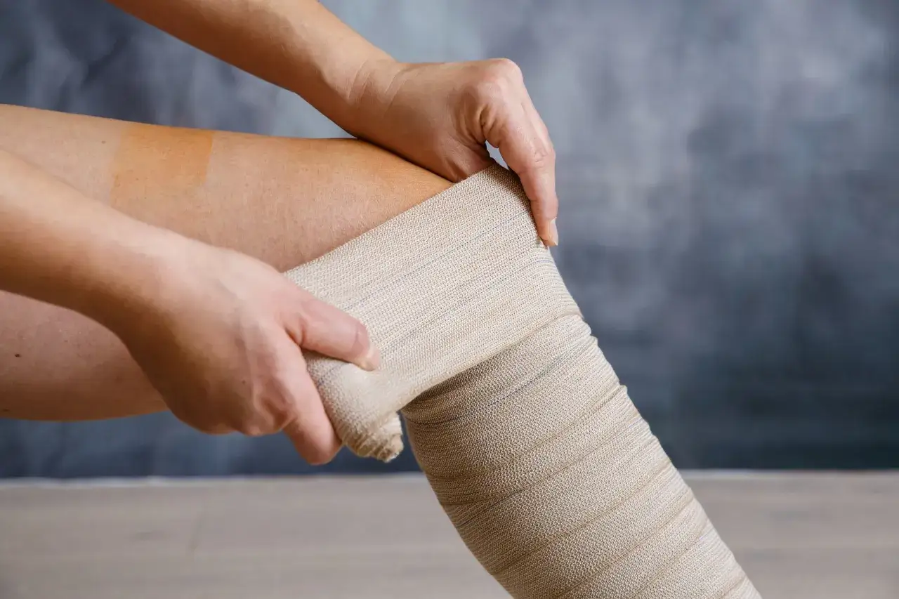 Applicazione di una benda elastica su una gamba, utile per il trattamento di ulcere venose.