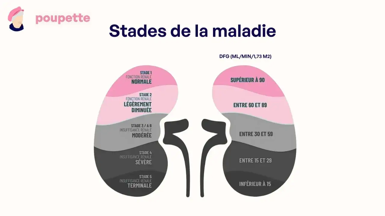 Sch&eacute;ma des stades de la maladie r&eacute;nale, de la fonction normale &agrave; l'insuffisance terminale. Un taux de cr&eacute;atinine haut indique une fonction r&eacute;nale diminu&eacute;e.