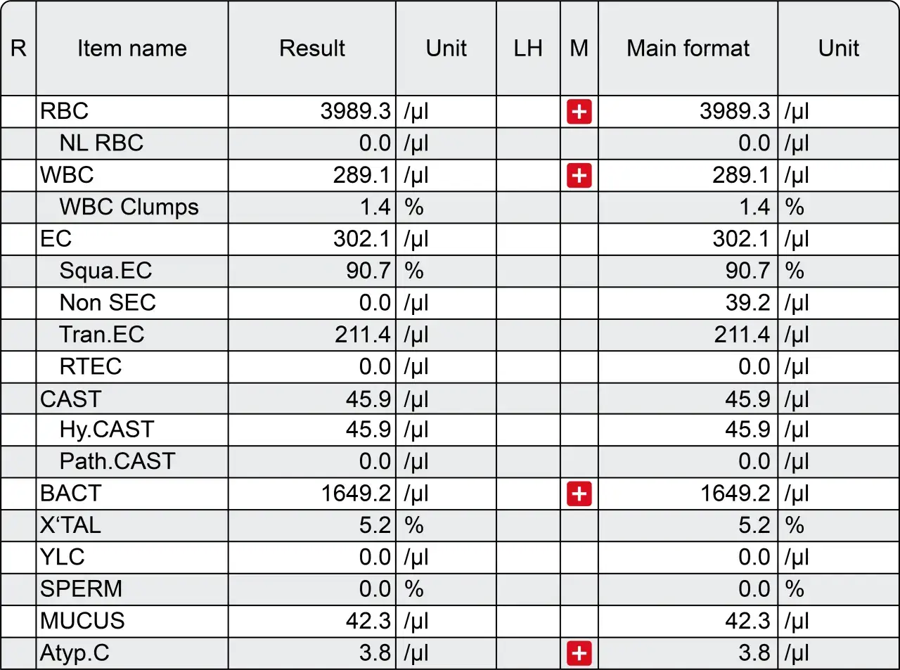 Tabela wyników badań krwi i moczu, zawierająca parametry takie jak RBC, WBC, EC, SPERM. Informacje o tym, jak długo są ważne wyniki badania krwi i moczu, nie są tu zawarte.