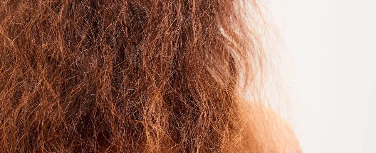 Primer plano de pelo deshidratado, de color rojizo, con puntas abiertas y aspecto áspero.