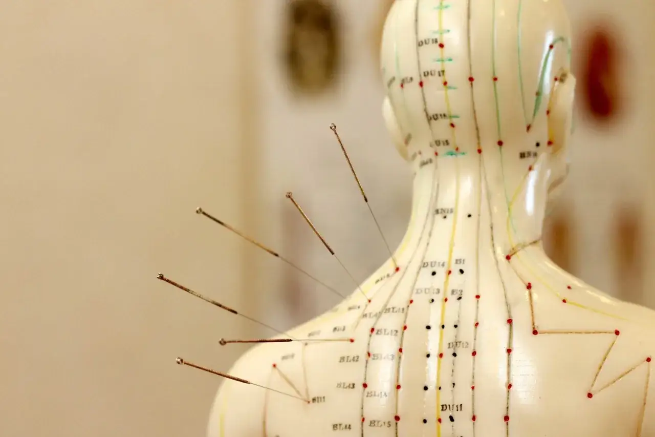Modello anatomico con aghi inseriti in vari punti di agopuntura sulla schiena e sul collo, evidenziando i meridiani.