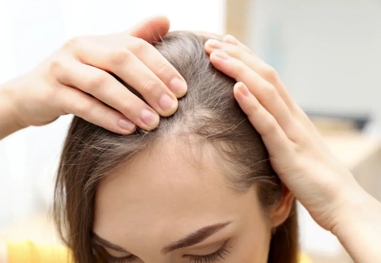 Manos revisando el cuero cabelludo, buscando soluciones para evitar caída del cabello.