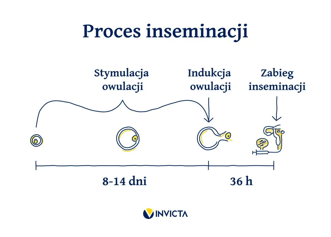 Schemat procesu inseminacji: stymulacja owulacji (8-14 dni), indukcja owulacji, zabieg inseminacji (36 h).