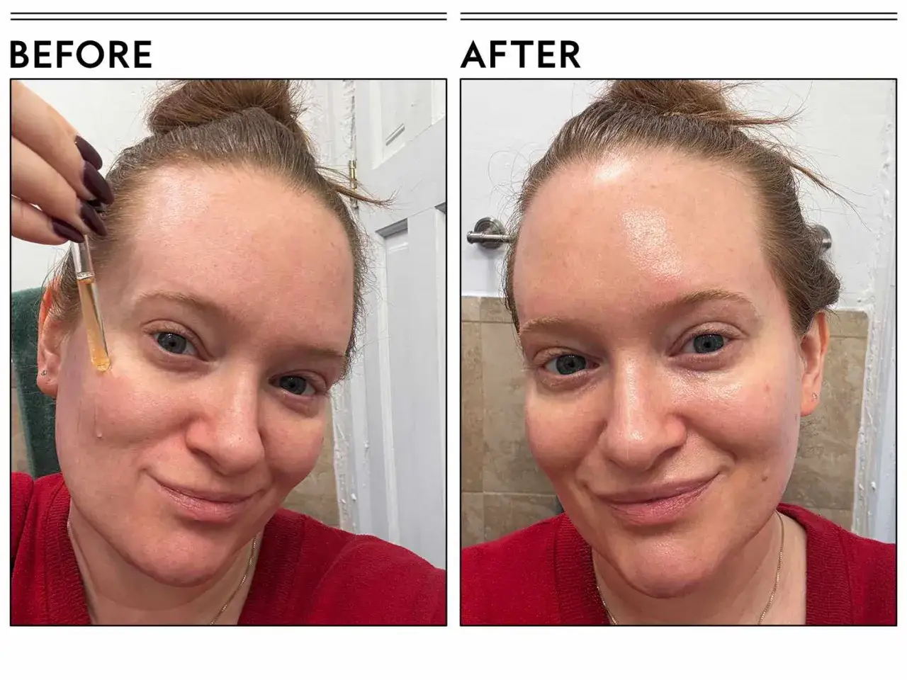 Prima e dopo: una donna applica un siero alla vitamina C, mostrando una pelle pi&ugrave; luminosa e idratata. Scopri a cosa serve la vitamina C siero!