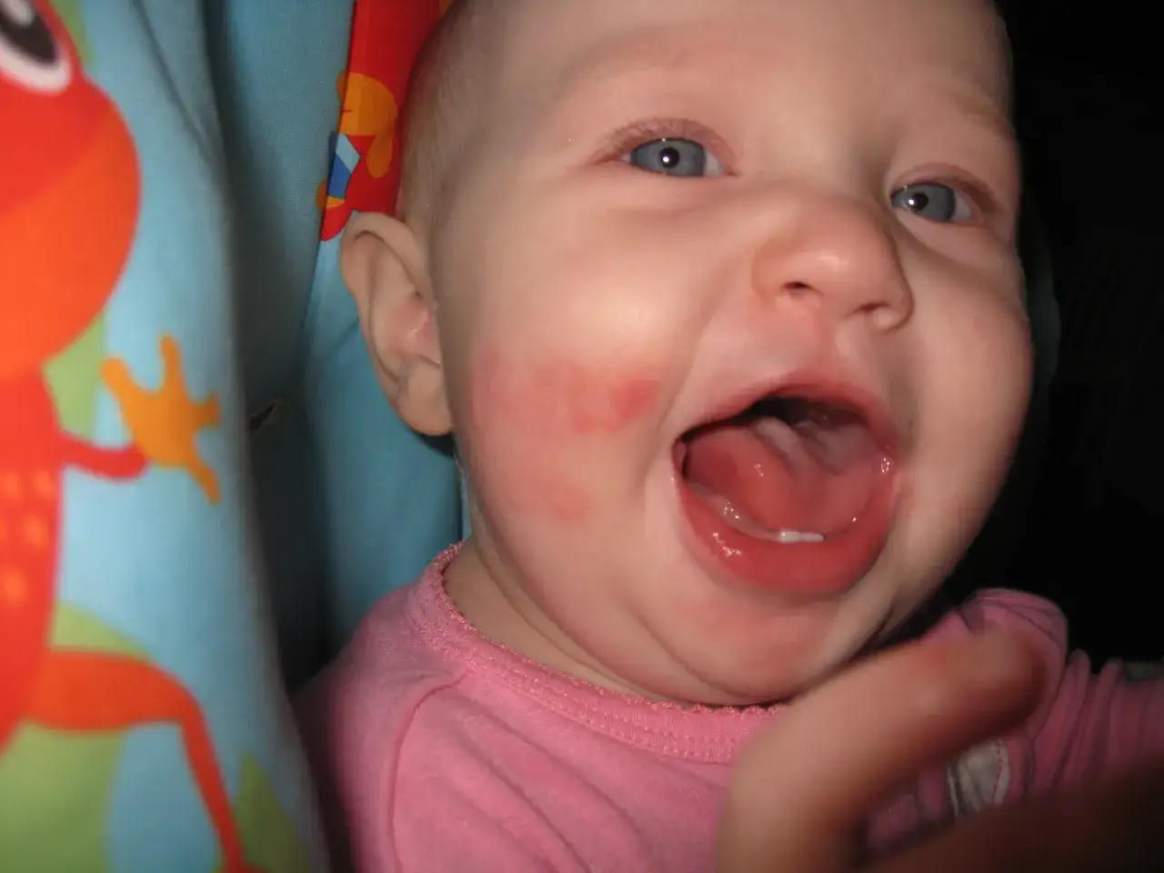 B&eacute;b&eacute; riant avec des rougeurs sur la joue, peut-&ecirc;tre une r&eacute;action &agrave; une kiwi allergie.