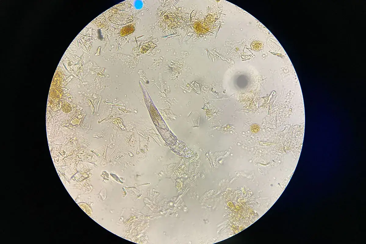 Mikroskopische Aufnahme zeigt einen Demodex-Milbenk&ouml;rper, der sich durch Zelltr&uuml;mmer schl&auml;ngelt. Was ist Demodex? Ein winziger Parasit.