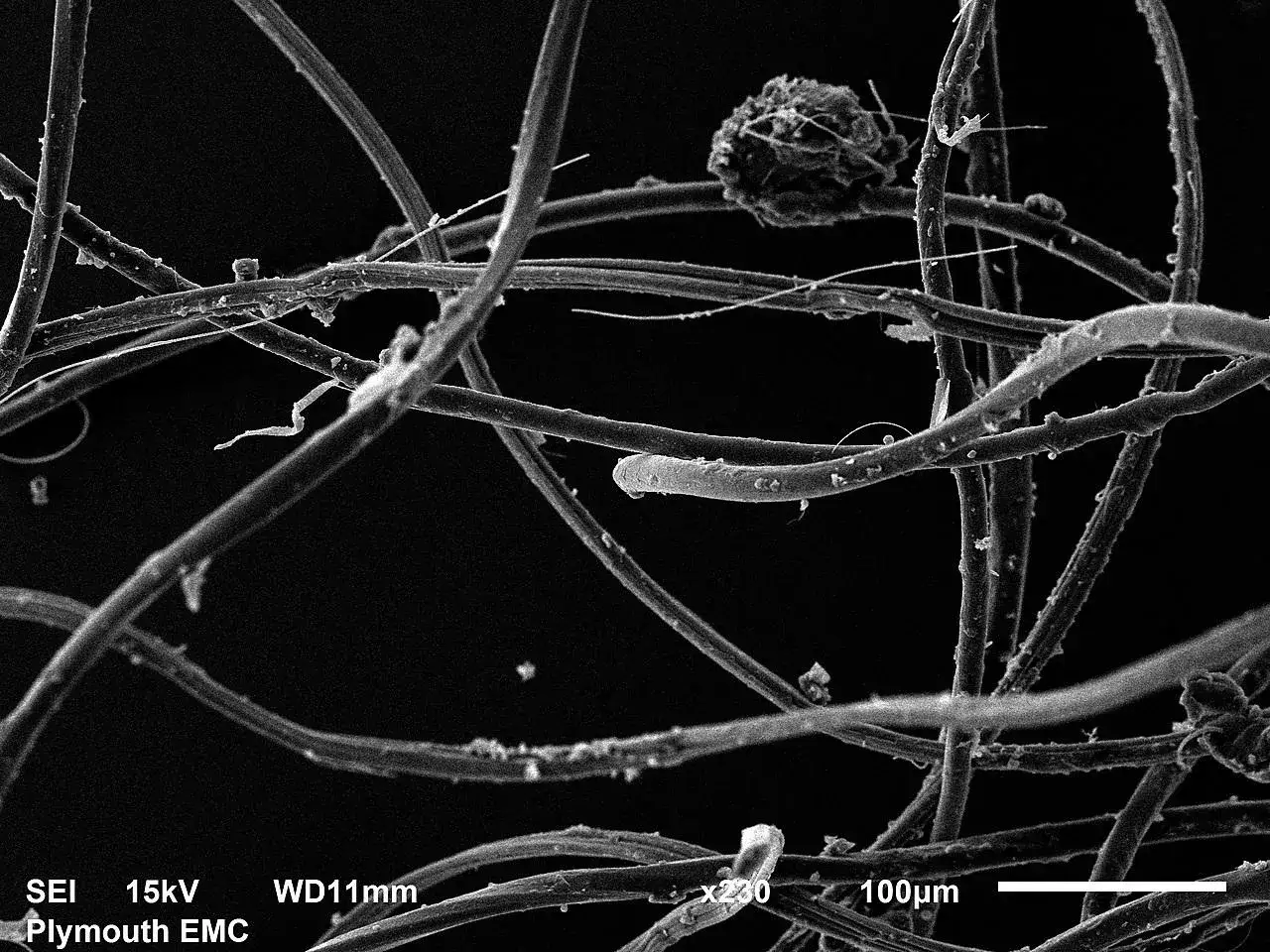 Rasterelektronenmikroskopische Aufnahme von Polyesterfasern. Die feinen Strukturen zeigen, wie sch&auml;dlich Polyester f&uuml;r die Umwelt sein kann, wenn es zerf&auml;llt.