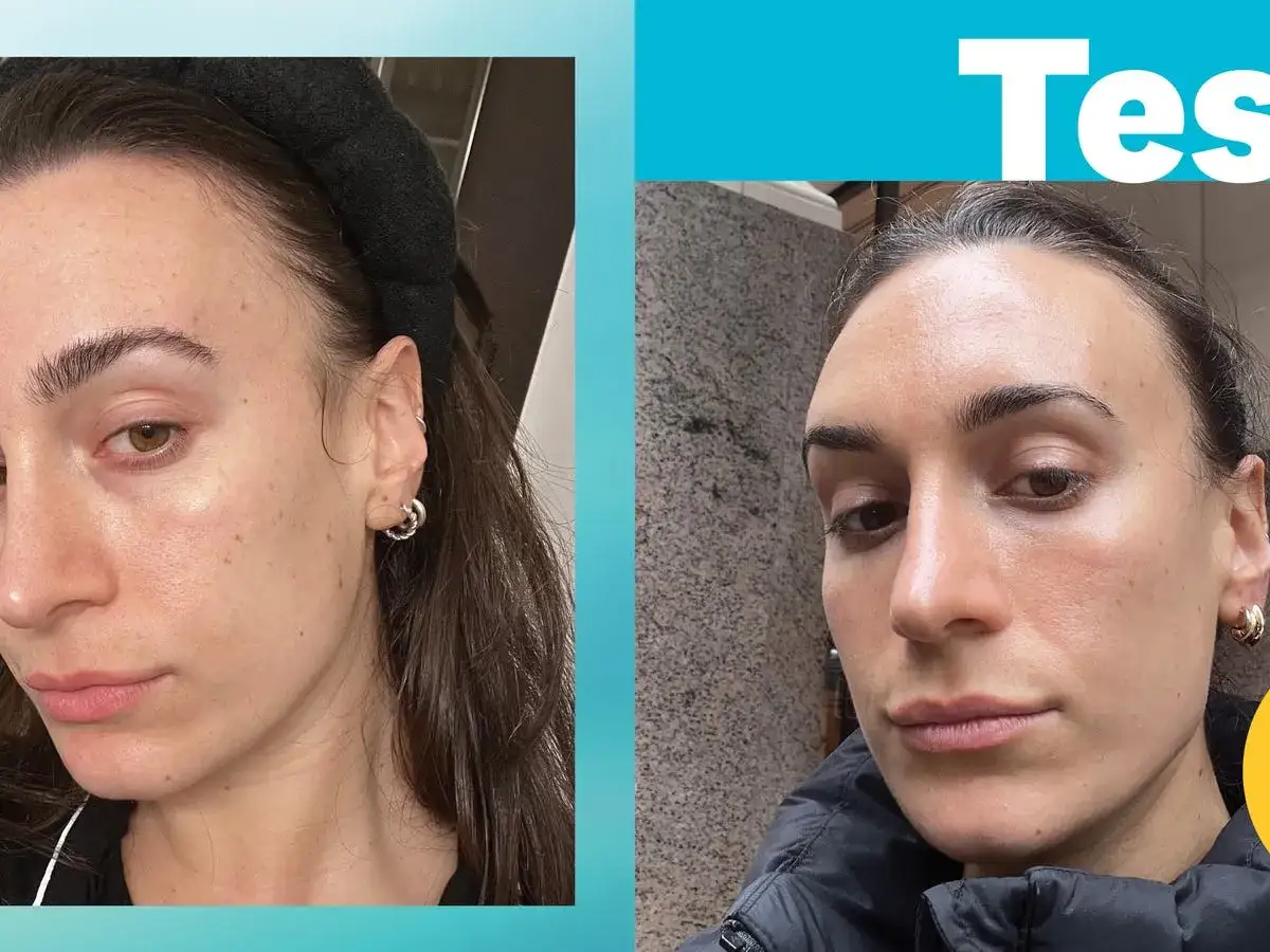 Por&oacute;wnanie sk&oacute;ry przed i po kuracji. Widoczne **retinol efekty**: redukcja przebarwień i poprawa tekstury cery.