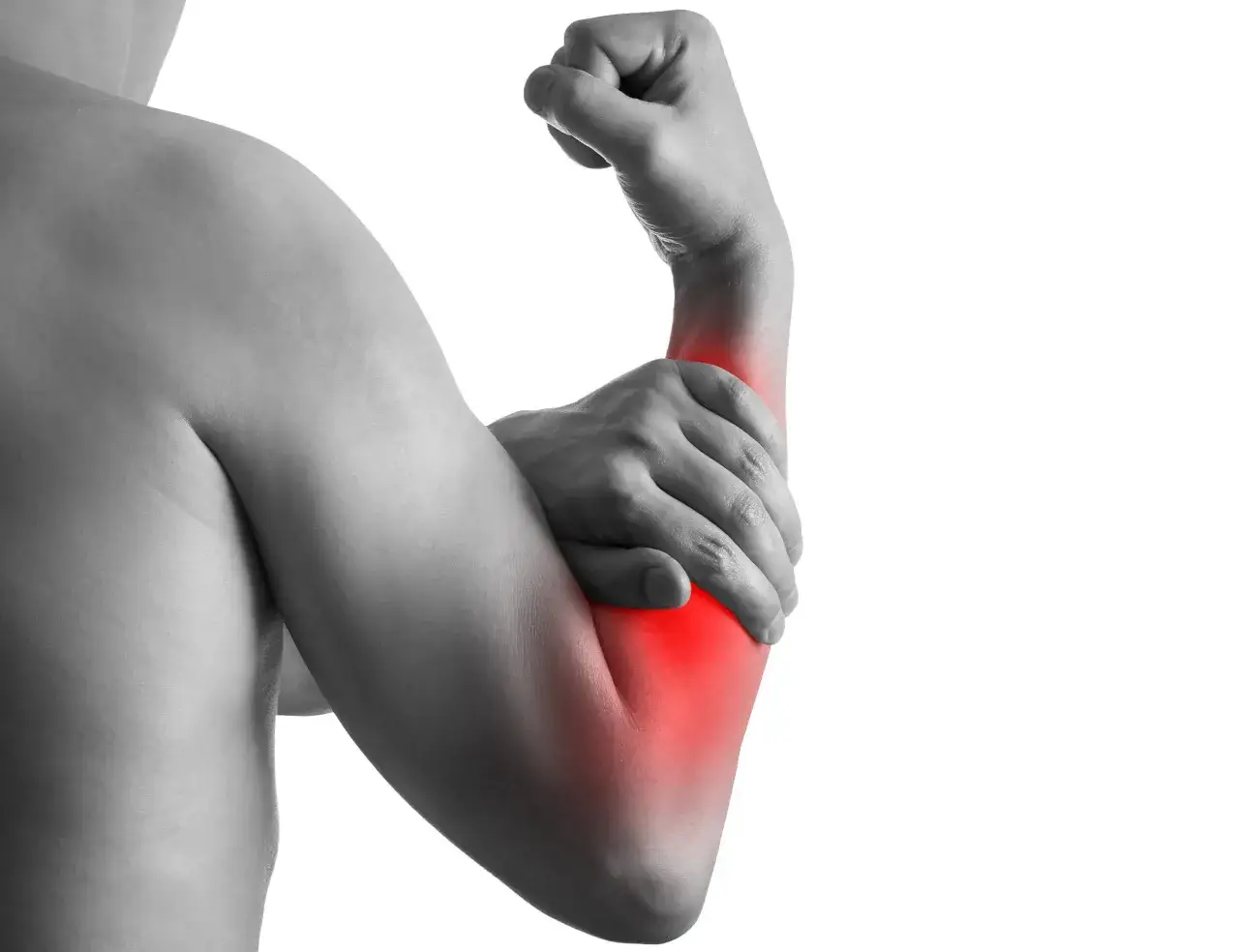 Schmerz im Unterarm, der den m. brachioradialis betrifft. Rote Markierung zeigt den entzündeten Bereich.