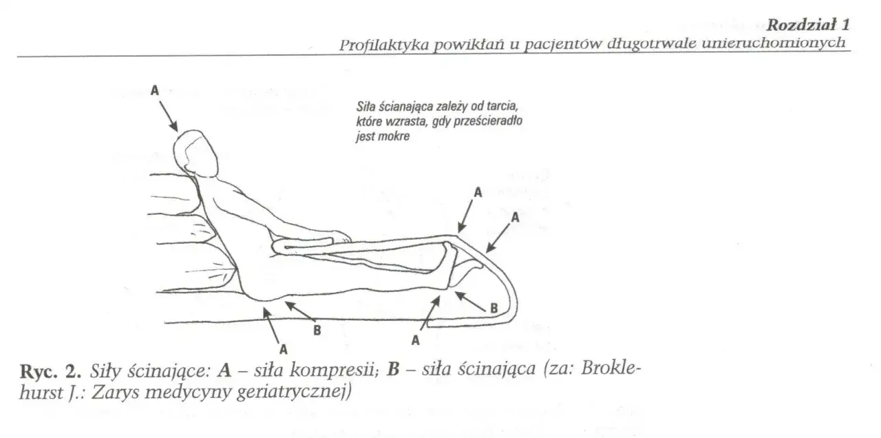 Ilustracja pokazuje siły działające na ciało pacjenta w ł&oacute;żku, kt&oacute;re mogą prowadzić do odleżyn od tarcia i ucisku.