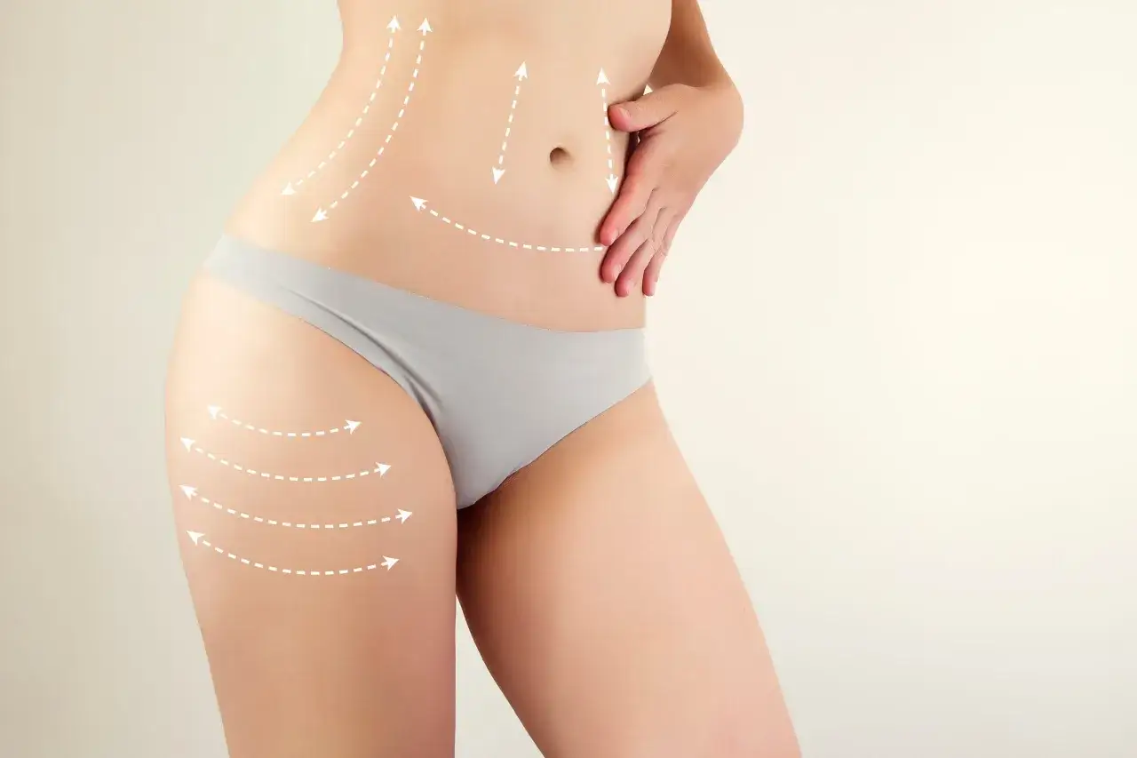 Kobieta z zaznaczonymi strzałkami obszarami na brzuchu i udach, sugerującymi zabiegi body wrapping kosmetyki.