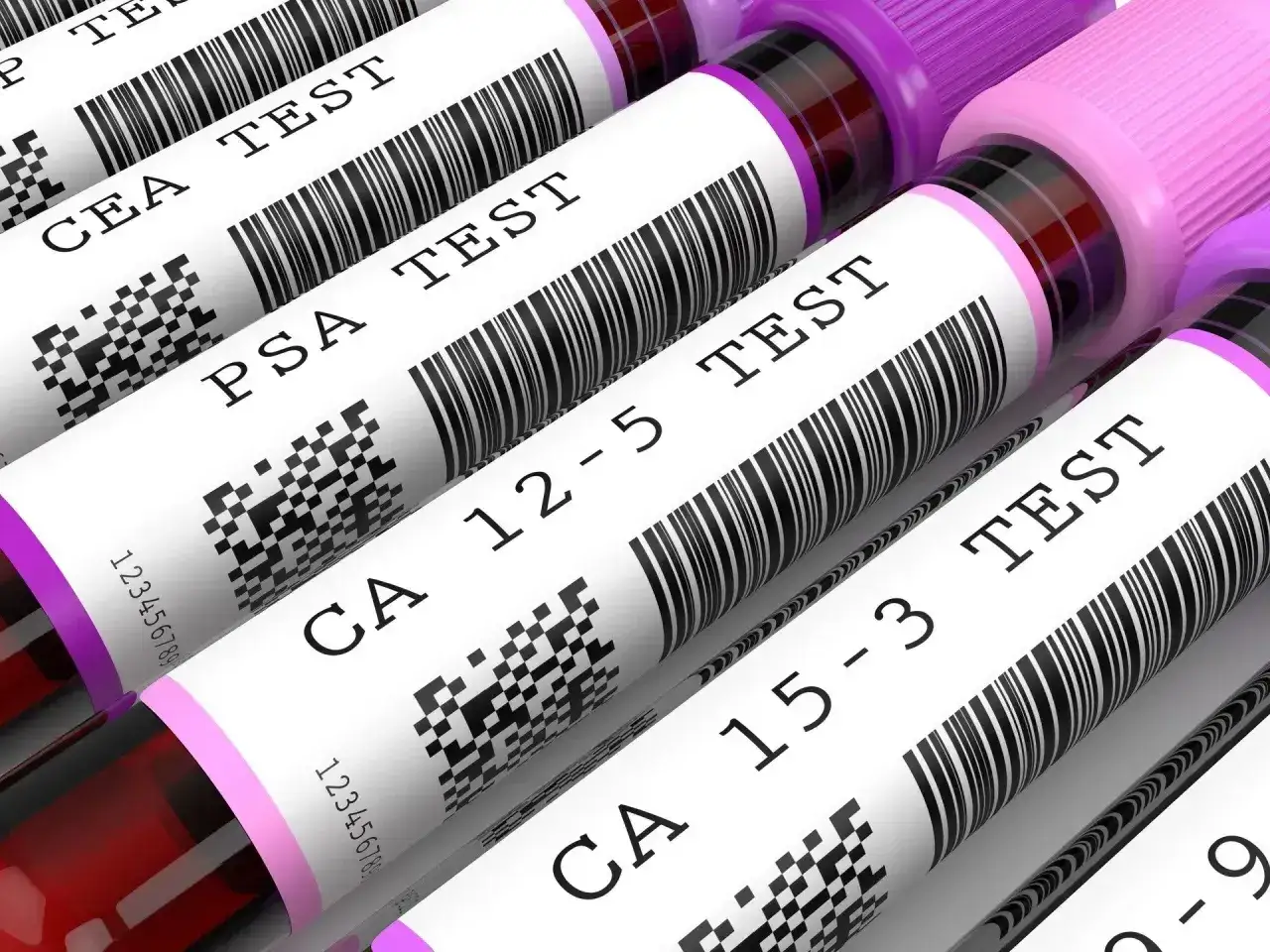 Rząd probówek z próbkami krwi do badań, w tym testów CEA, PSA, CA 12-5 i CA 15-3.