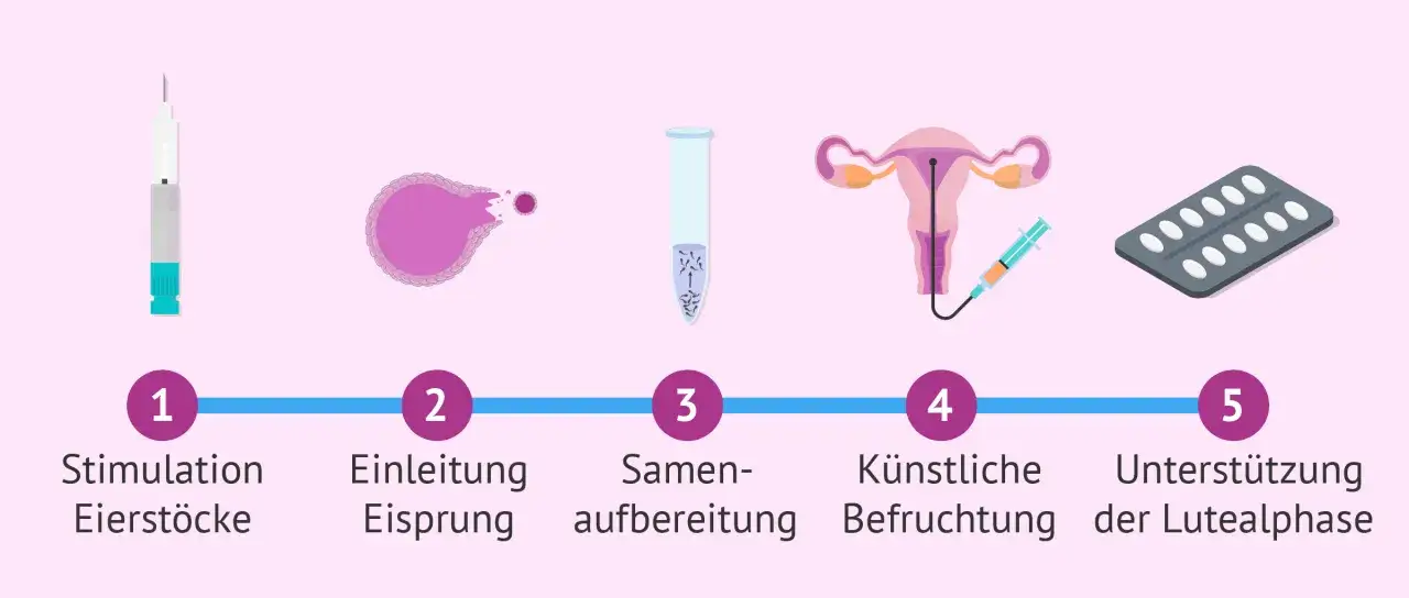 Der insemination ablauf: Stimulation der Eierst&ouml;cke, Einleitung des Eisprungs, Samenvorbereitung, k&uuml;nstliche Befruchtung und Unterst&uuml;tzung der Lutealphase.