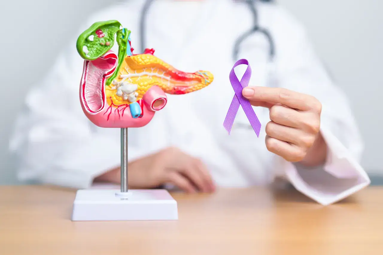 Model trzustki i fioletowa wstążka symbolizująca walkę z rakiem. Wczesne wykrycie kluczowe dla leczenia, świadomość objawów raka trzustki ratuje życie.