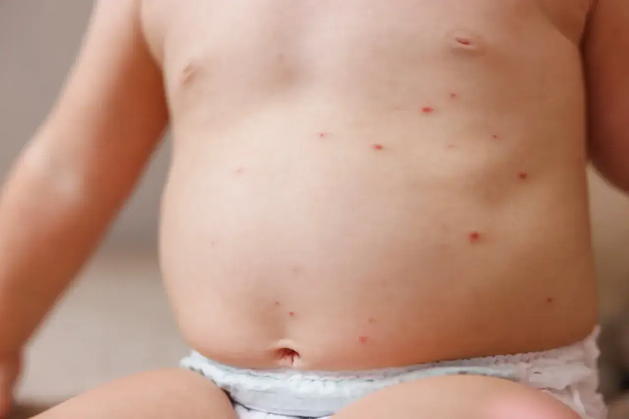 Un petit ventre de b&eacute;b&eacute; avec quelques petits boutons rouges.