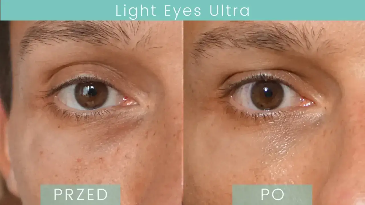 Men's Lab rewitalizujący żel pod oczy opinie przed po