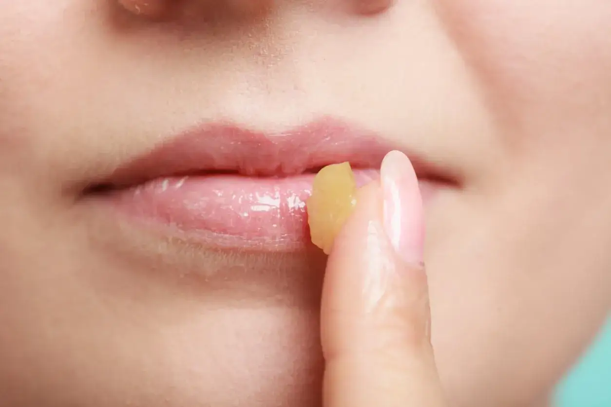 Dita applica un balsamo sulle labbra, un rimedio della nonna per labbra infiammate.
