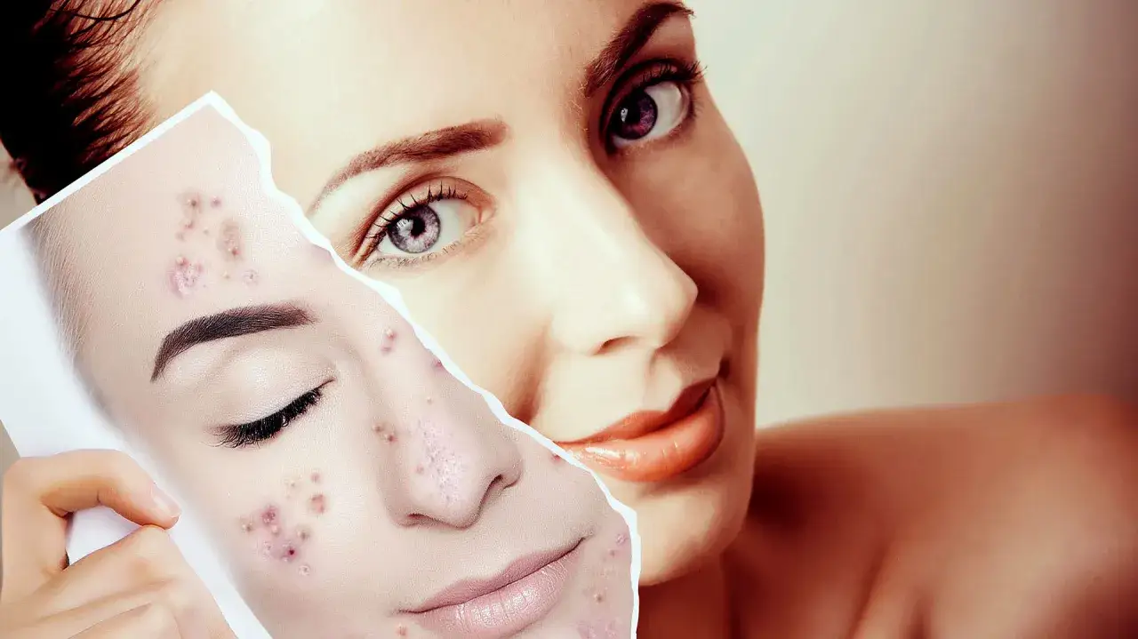Mujer sonríe mientras sostiene una foto de su rostro con granitos.