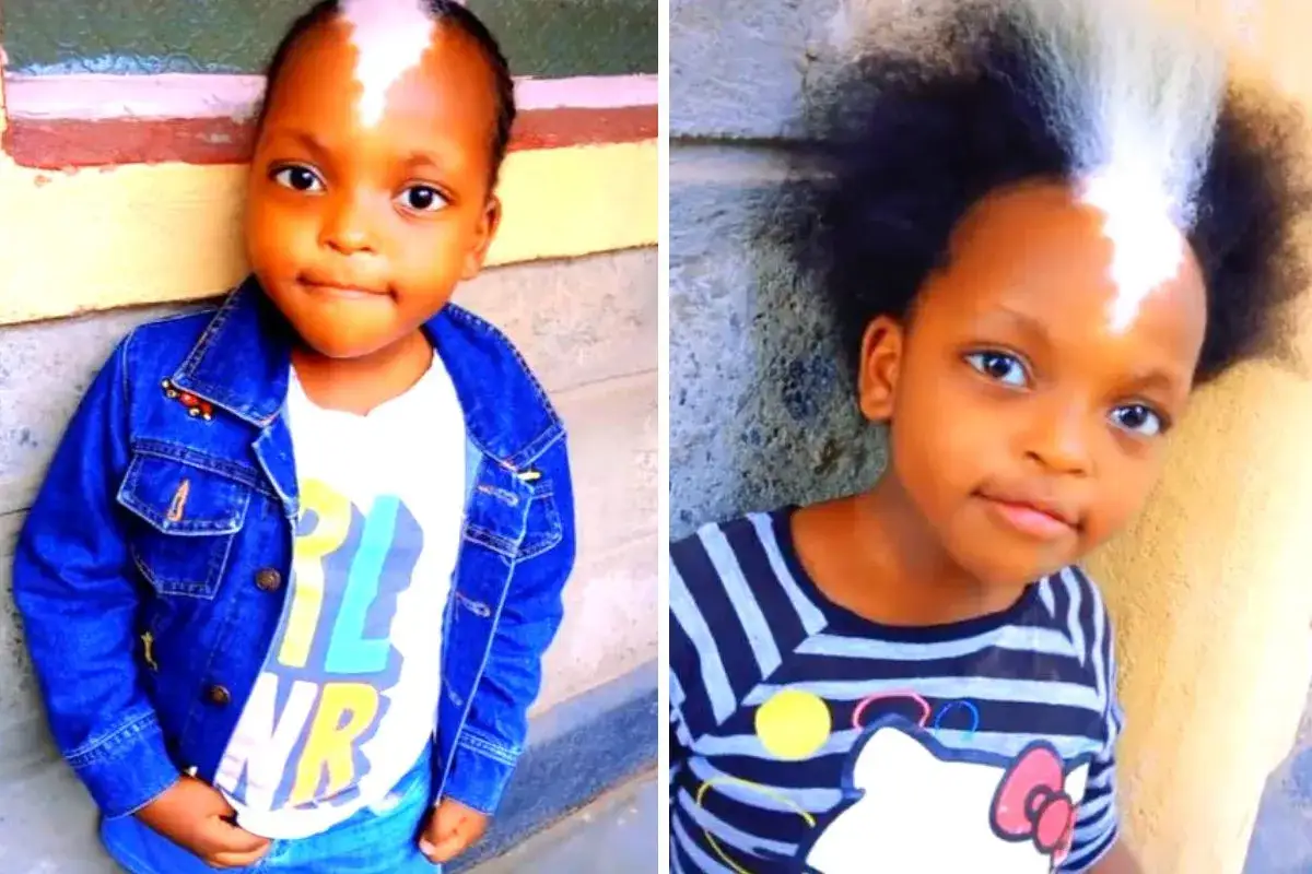 Bambina con una ciocca di capelli bianchi, un segno distintivo del suo piebaldismo. Indossa una giacca di jeans e una maglietta.