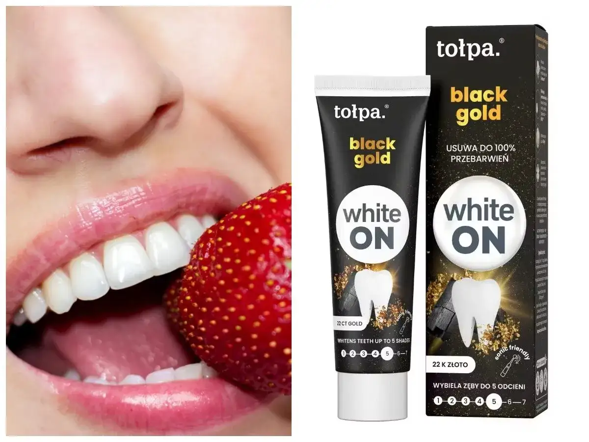 Uśmiech z truskawką i tubka pasty tołpa. black gold white ON – jaka pasta wybielająca zapewni taki efekt?