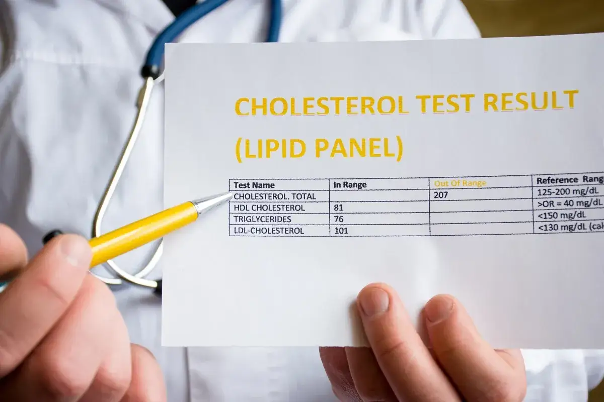 Lekarz pokazuje wynik badania lipidogramu, wskazując na podwyższony poziom cholesterolu. Suvardio może pomóc w monitorowaniu parametrów.