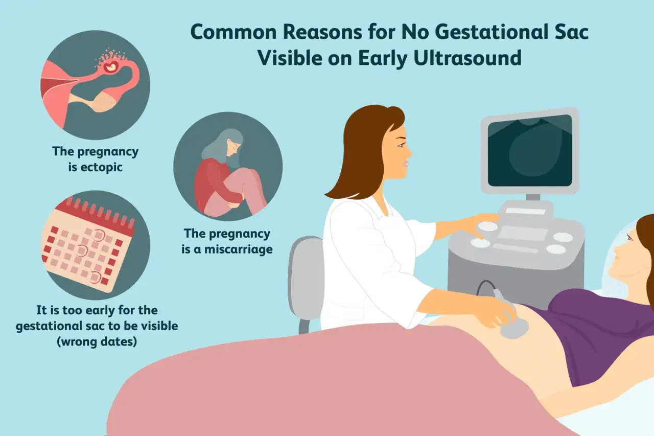 Motivi per cui la camera gestazionale vuota non &egrave; visibile all'ecografia precoce: gravidanza ectopica, aborto spontaneo, o troppo presto.