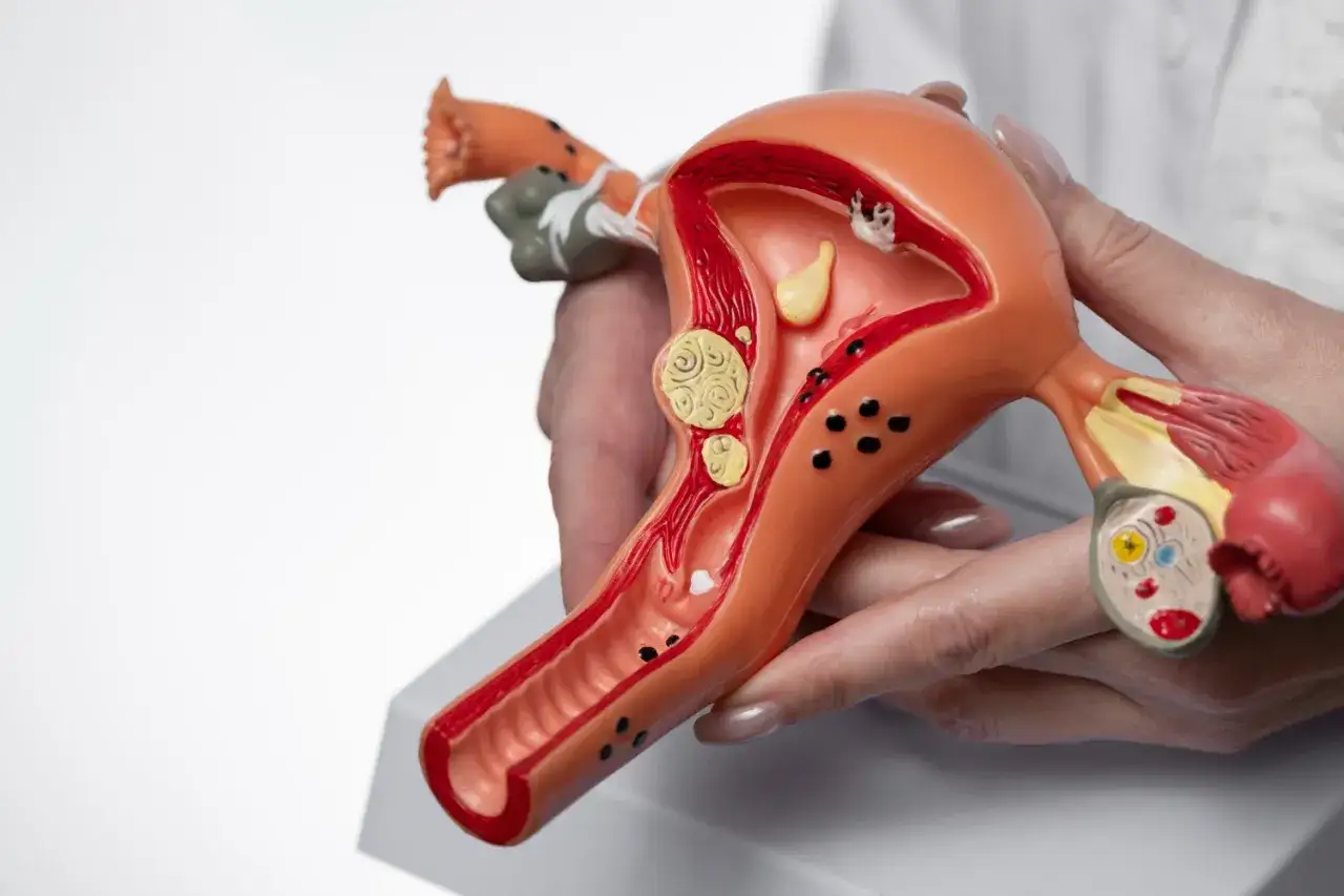 Modello anatomico dell'utero e delle tube di Falloppio, con dettagli che potrebbero rappresentare infezioni come l'ureaplasma parvum in gravidanza.