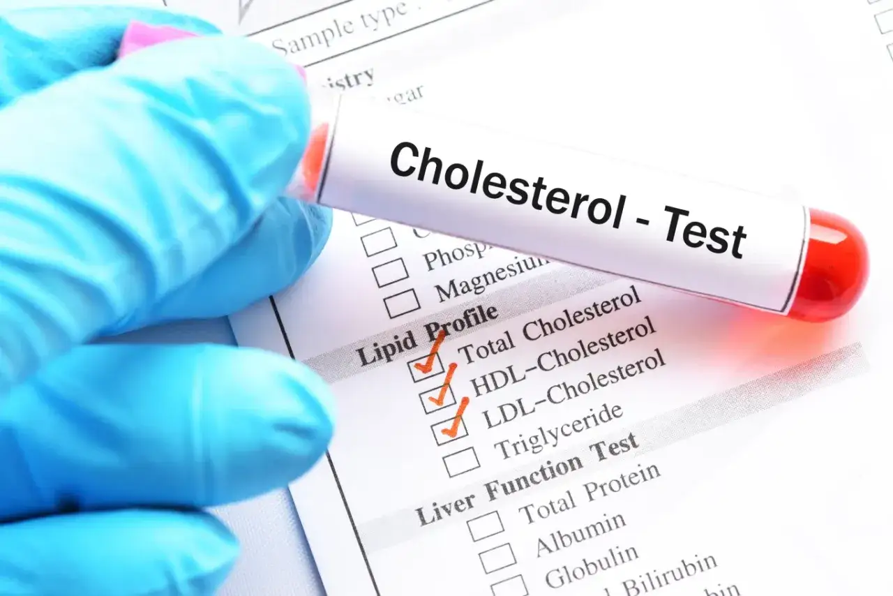 Ręka w niebieskiej rękawiczce trzyma probówkę z krwią do testu na cholesterol. Na formularzu zaznaczono lipidogram.