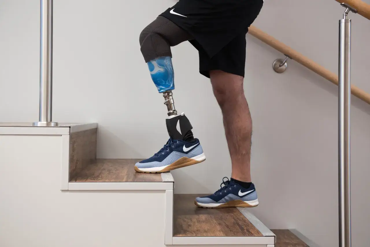Mann mit Beinprothese steigt Treppen. Ein Beispiel für die Bewältigung des Alltags mit Beinamputation und möglicher Pflegestufe.