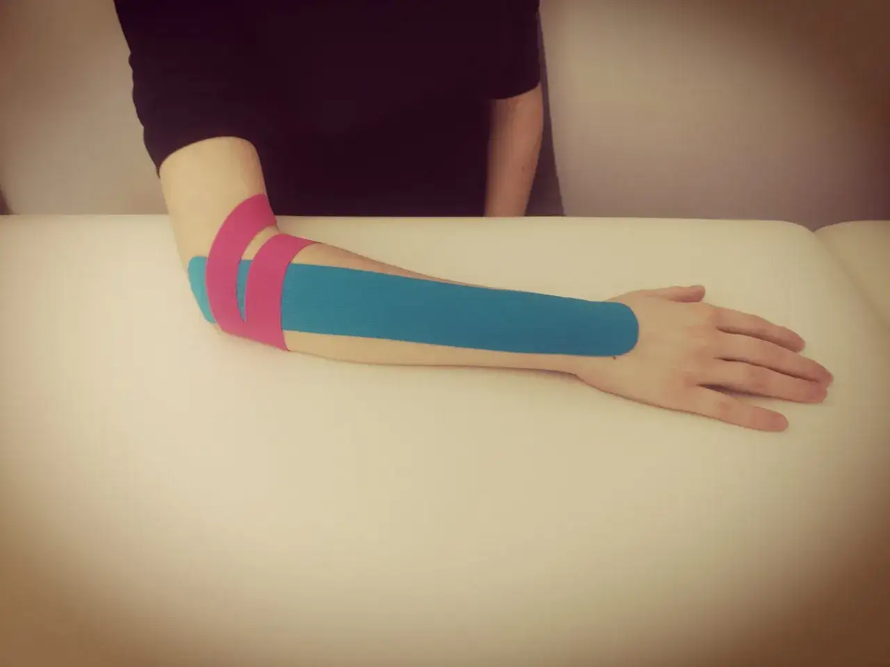 Ramię z aplikacją kinesiotaping na łokieć tenisisty (M77.1 ICD-10).