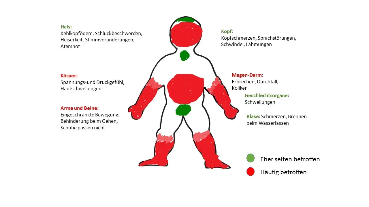 Zdjęcie Symptome von Magen Darm: Warnzeichen einer ernsten Infektion erkennen