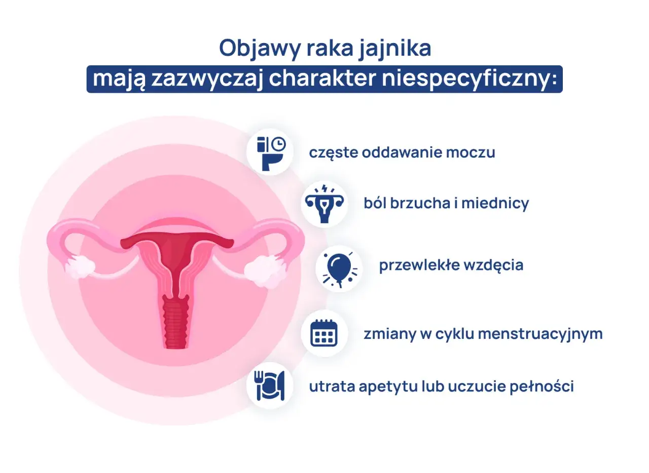 Ilustracja przedstawia narządy rodne kobiety i objawy raka jajnika: częste oddawanie moczu, ból brzucha, wzdęcia, zmiany cyklu, utratę apetytu.