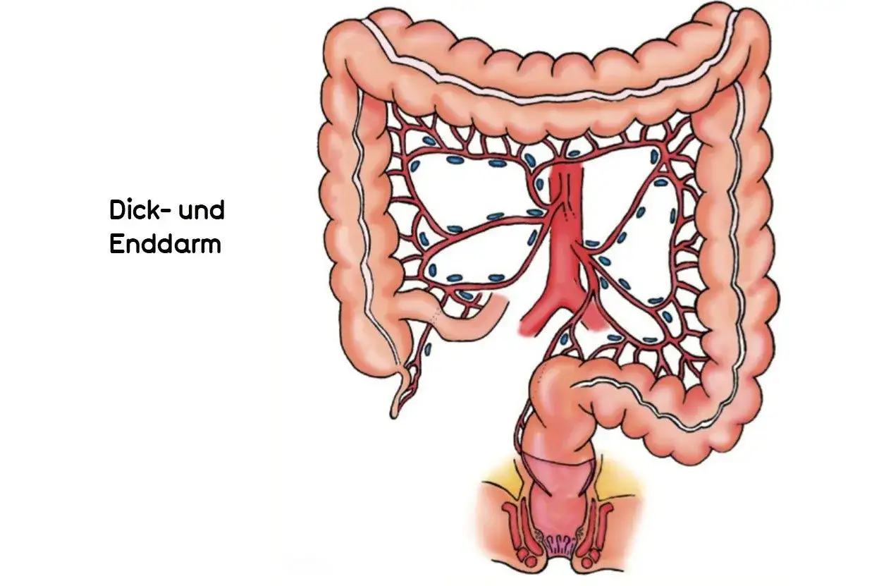 Darstellung des Dick- und Enddarms mit Blutgefäßen. Hier wird gezeigt, wohin Darmkrebs streuen kann, über Lymphbahnen und Blutgefäße.