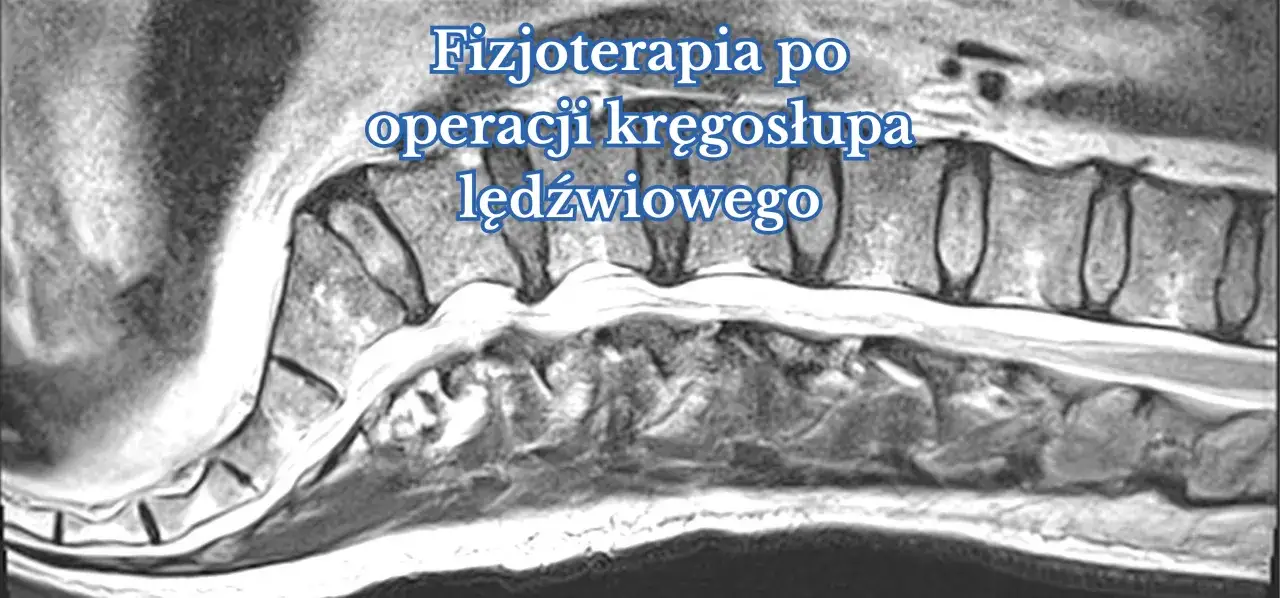 fizjoterapeuta wspiera pacjenta po operacji kręgosłupa