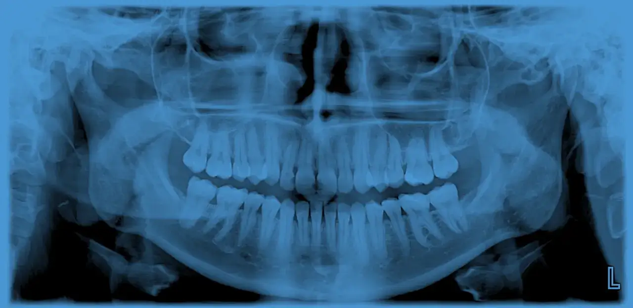 Pantomogram z opisem struktur anatomicznych