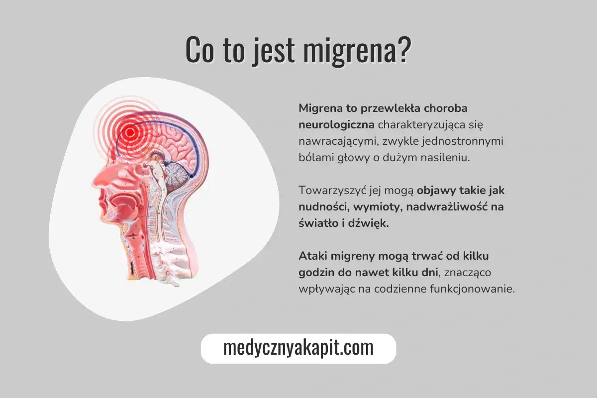 Anatomia głowy z zaznaczonym pulsującym bólem. Migrena to choroba neurologiczna z nawracającymi, silnymi bólami głowy.