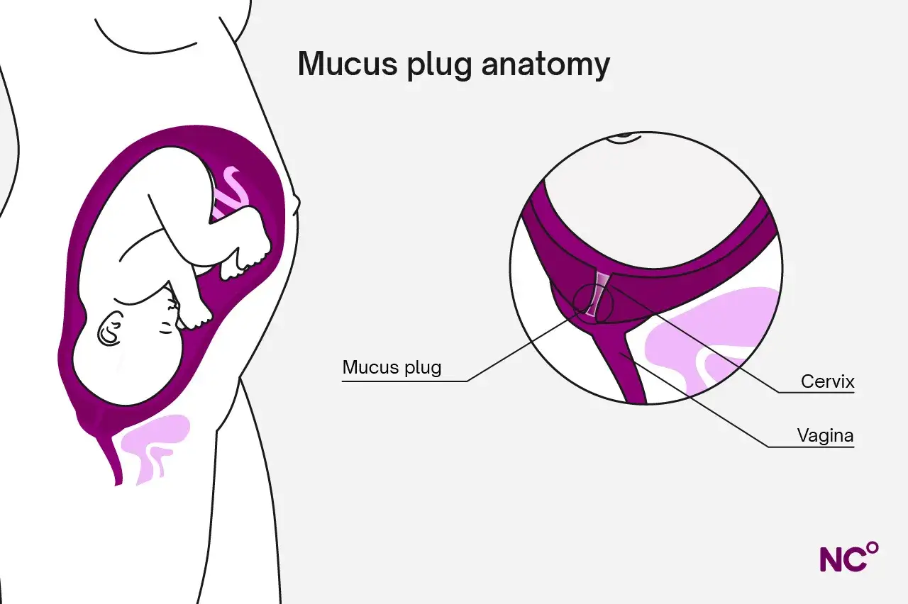Ilustraci&oacute;n de anatom&iacute;a del tap&oacute;n mucoso. Muestra un &uacute;tero con un feto y un primer plano del cuello uterino y la vagina, donde se ve el tap&oacute;n mucoso.