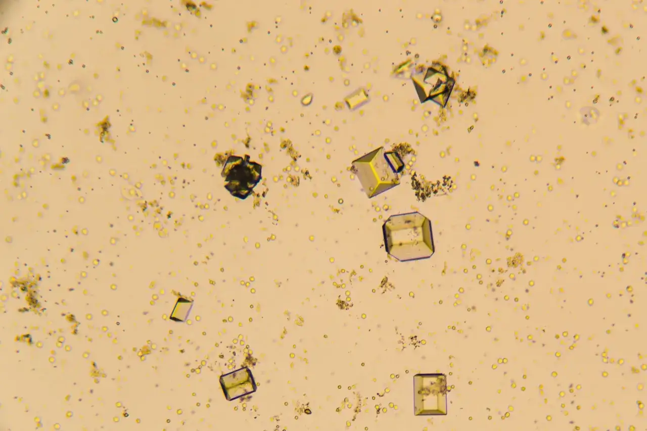 Widoczne pod mikroskopem kryształy w moczu, niektóre o regularnych, sześciennych kształtach, unoszą się wśród drobnych kuleczek.