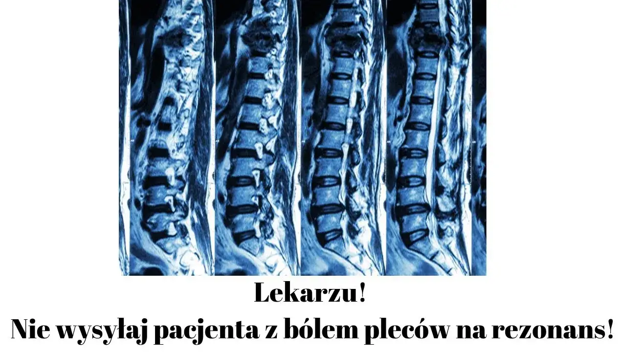 Rezonans magnetyczny kręgosłupa lędźwiowego rwa kulszowa