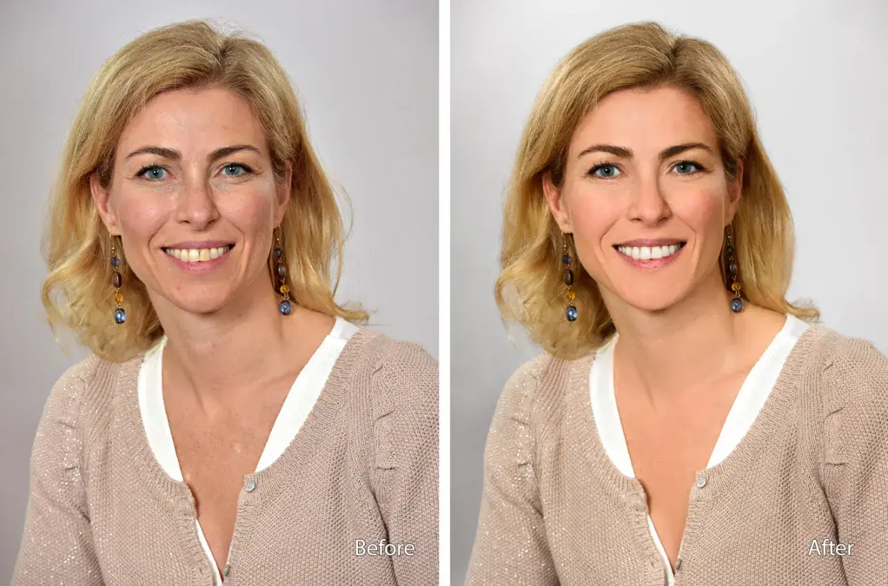 Avant/Après : une femme souriante, mise en valeur par une retouche photo professionnelle qui illumine son visage et lisse sa peau.