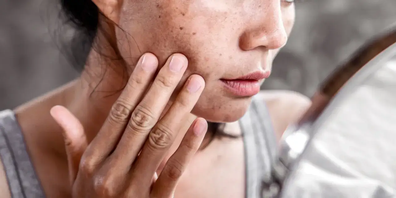 Une femme examine sa peau tachet&eacute;e, craignant une **huile de ricin allergie**.