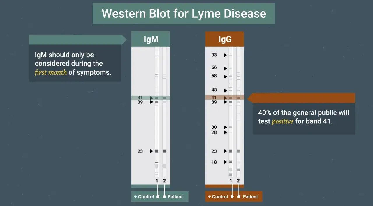 Western Blot dla boreliozy: por&oacute;wnanie wynik&oacute;w IgM i IgG. IgM tylko w pierwszym miesiącu. 40% populacji ma pozytywny wynik dla pasma 41.