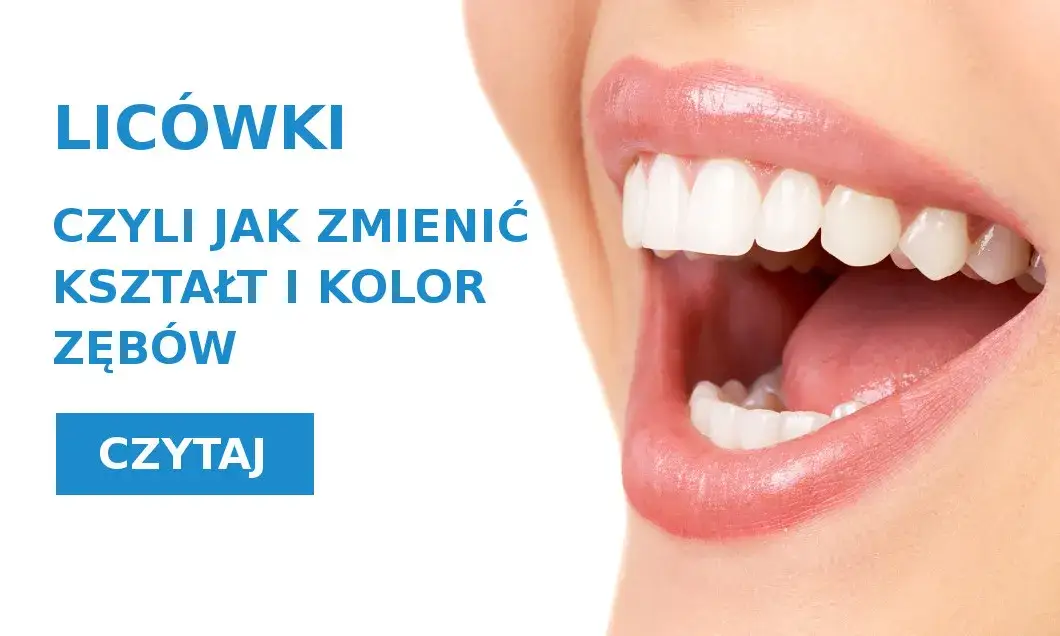 Zdjęcie Jaki kolor zęb&oacute;w wybrać, aby uniknąć sztucznego uśmiechu?